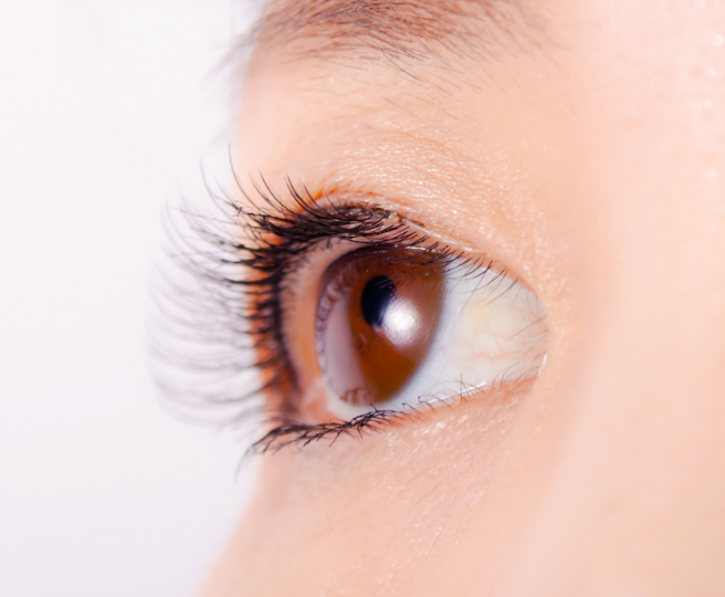 グラッシュビスタ®