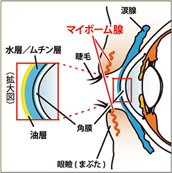 マイボーム腺機能不全(MGD)・ドライアイに対する治療